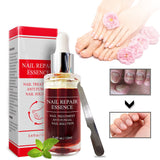 Herbal Nail Fungus removal Oil